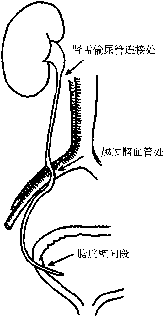 第三节 输尿管